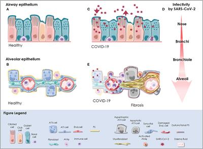 Human-Based Advanced in vitro Approaches to Investigate Lung Fibrosis and Pulmonary Effects of COVID-19